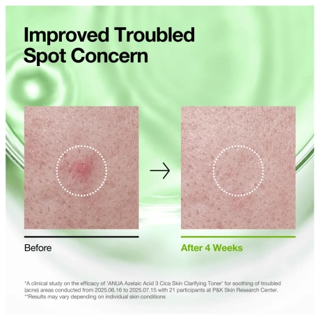 ANUA Azelaic Acid 3 Cica Skin Clarifying Toner