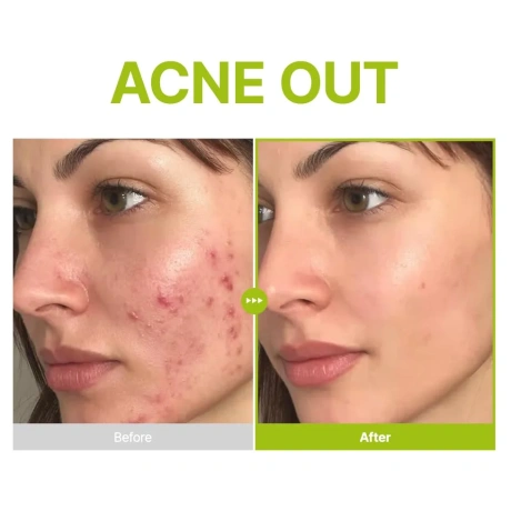 PURITO SEOUL Azelaic Acid 10 Kojic Azulene Serum