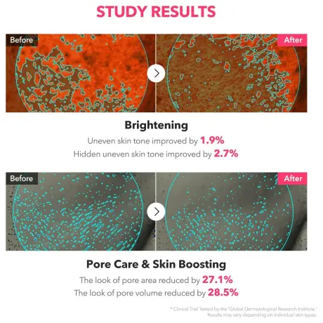 APRIL SKIN TXA Niacinamide Toning Shot 99 Serum