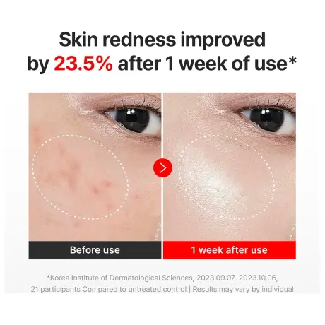 Centellian24 Madeca Cream Time Reverse