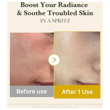 Medicube Kojic Acid Turmeric Vita Jelly Mist Serum