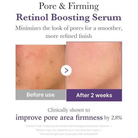 Medicube Retinol NMN Boosting Serum