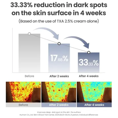AXIS-Y TXA 2.5 Intensive Brightening Cream