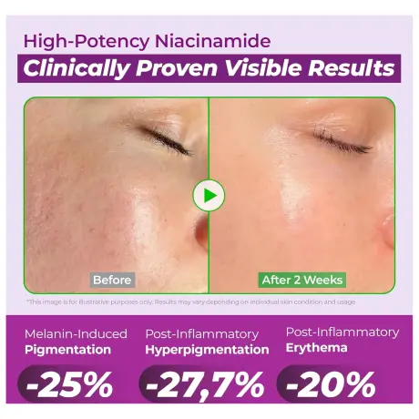 Jumiso Niacinamide 20 Serum