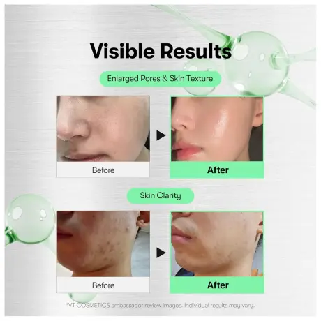 VT COSMETICS Reedle Shot 700