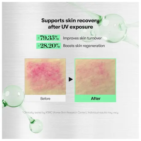 VT COSMETICS Reedle Shot 700