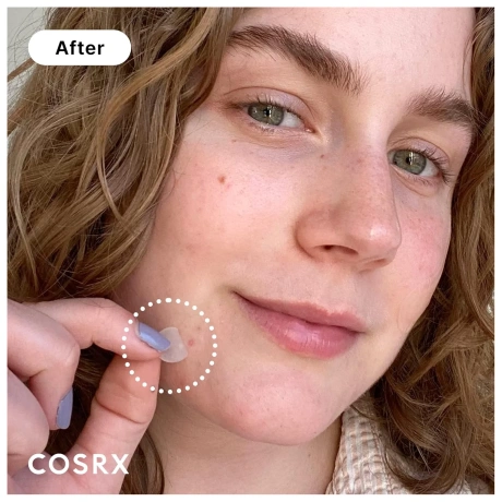 COSRX Acne Pimple Master