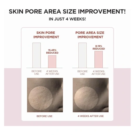 Skin1004 Madagascar Centella Poremizing Clear Toner