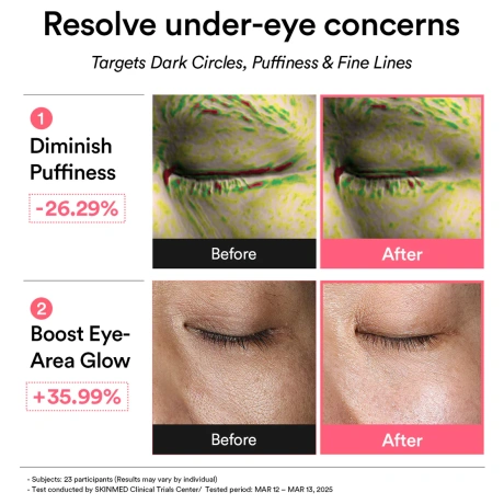 Abib PDRN Retinal Eye Patch Glow Jelly