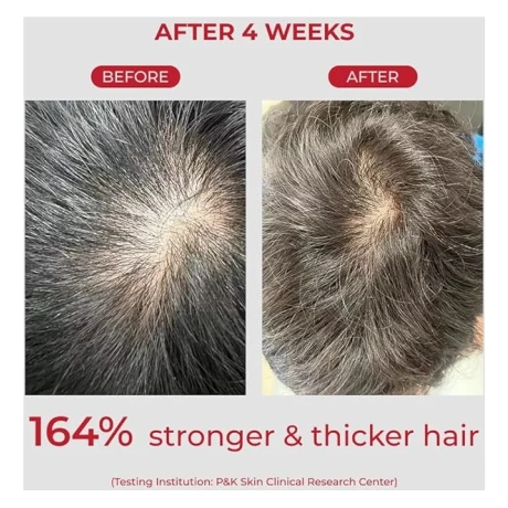 MOEV Annurcatin Shampoo