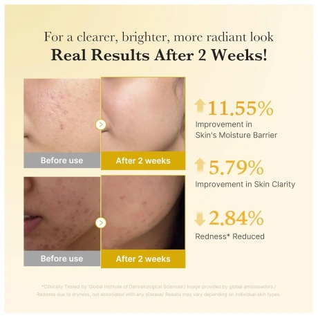 Medicube Kojic Acid Turmeric Niacinamide Serum