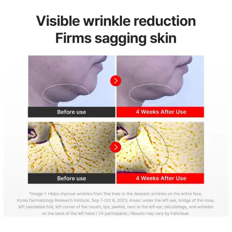 Centellian24 Madeca Cream Time Reverse