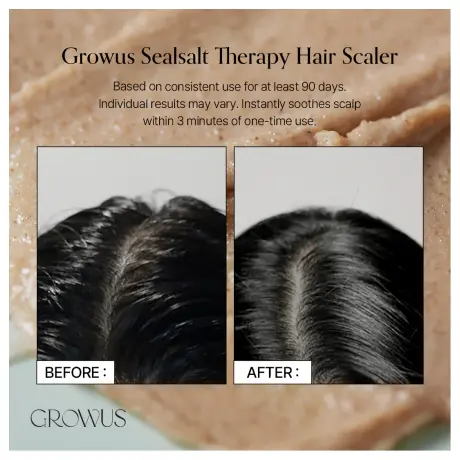 GROWUS Sea Salt Therapy Scalp Scaler