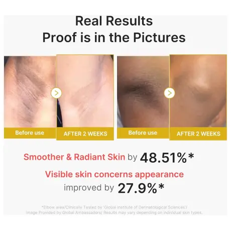 Medicube Kojic Acid Turmeric Body Peel Shot