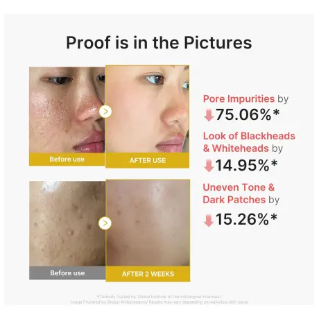 Medicube Kojic Acid Turmeric Peel Shot