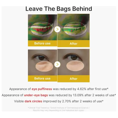 Medicube Kojic Acid Turmeric Vita Eye Gel Serum