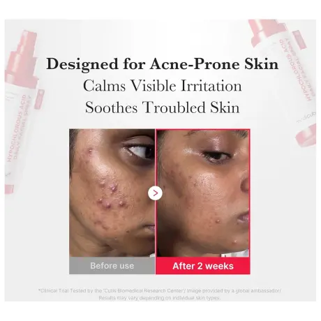 Medicube Hypochlorous Acid Daily Facial Spray