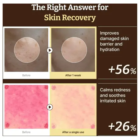 Dr. Reju-All Advanced PDRN Rejuvenating Cream