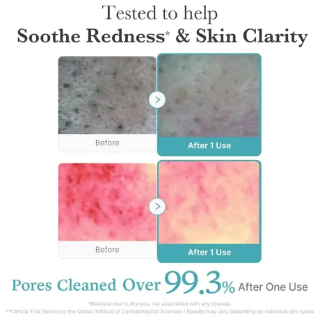 Medicube Azelaic Acid Niacinamide Deep Clean Foam Cleanser
