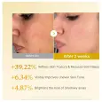 Medicube Kojic Acid Turmeric Resurfacing Toner