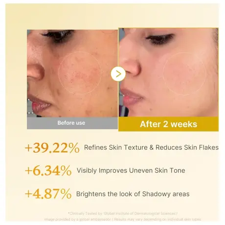 Medicube Kojic Acid Turmeric Resurfacing Toner